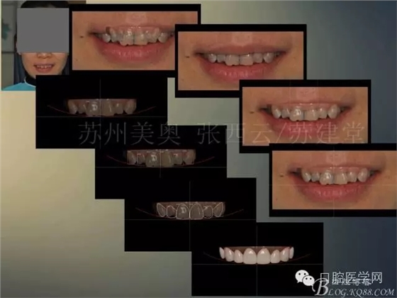 640.webp.jpg 640.webp.jpg