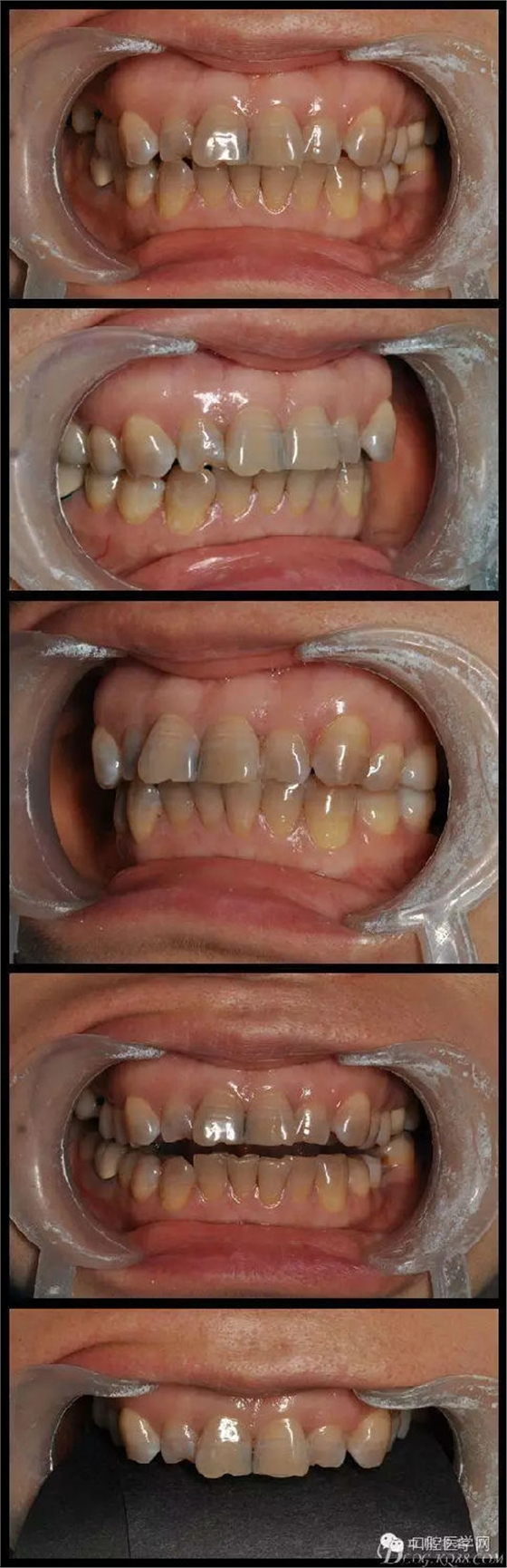 640.webp (1).jpg 640.webp (1).jpg