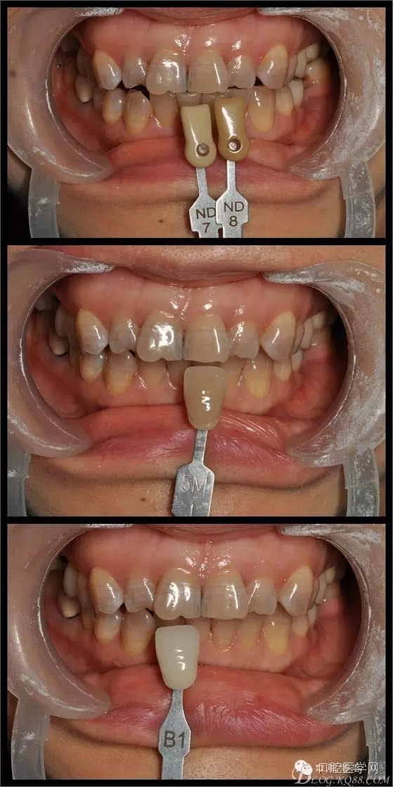 640.webp (6).jpg 640.webp (6).jpg