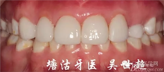 640.webp (16).jpg 640.webp (16).jpg