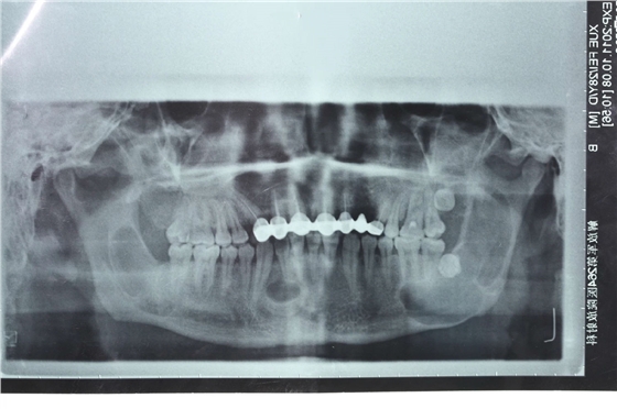 0.webp.jpg 0.webp.jpg