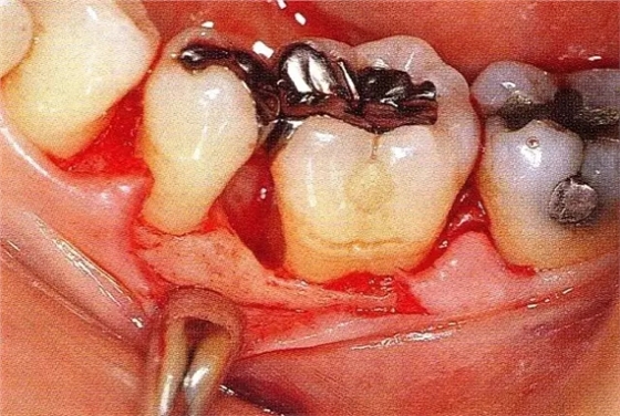 640.webp.jpg 640.webp.jpg