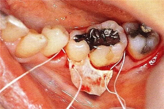 640.webp (2).jpg 640.webp (2).jpg