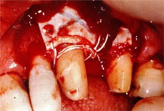 640.webp (11).jpg 640.webp (11).jpg