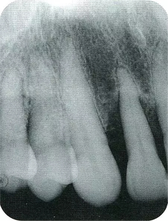 640.webp (17).jpg 640.webp (17).jpg