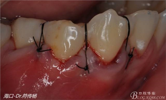 640 (15).jpg 640 (15).jpg