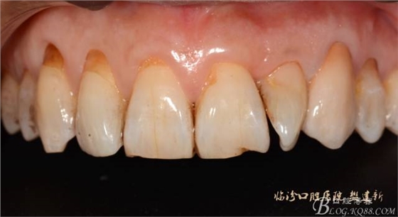 640 (11).jpg 640 (11).jpg