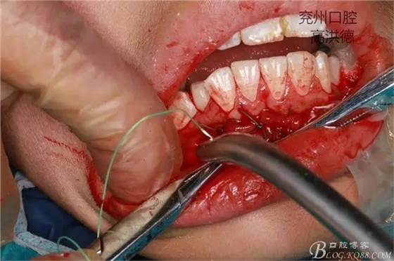 640 (17).jpg 640 (17).jpg