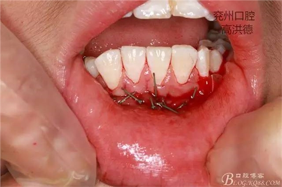 640 (19).jpg 640 (19).jpg