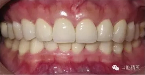 640.webp (1).jpg 640.webp (1).jpg