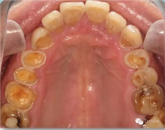 640.webp.jpg 640.webp.jpg