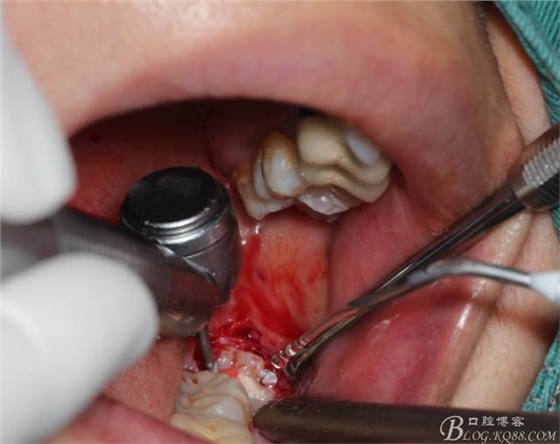 640 (11).jpg 640 (11).jpg