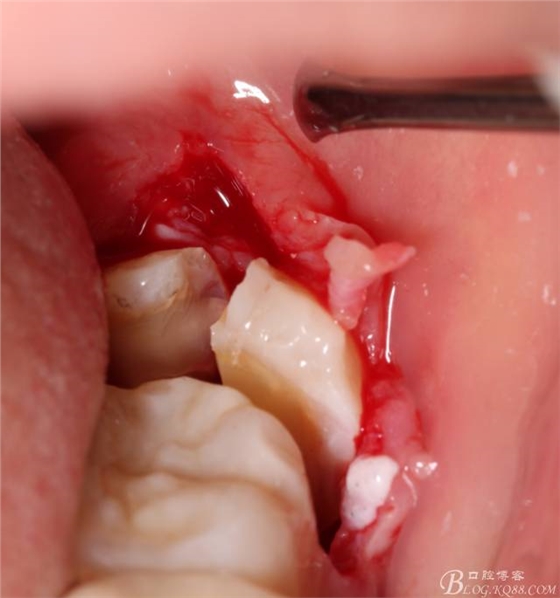 640 (15).jpg 640 (15).jpg