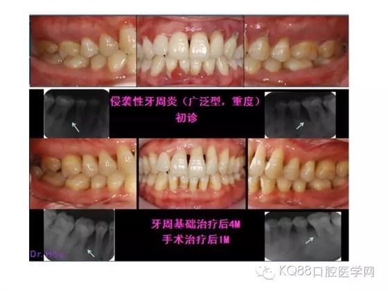 0.webp.jpg 0.webp.jpg