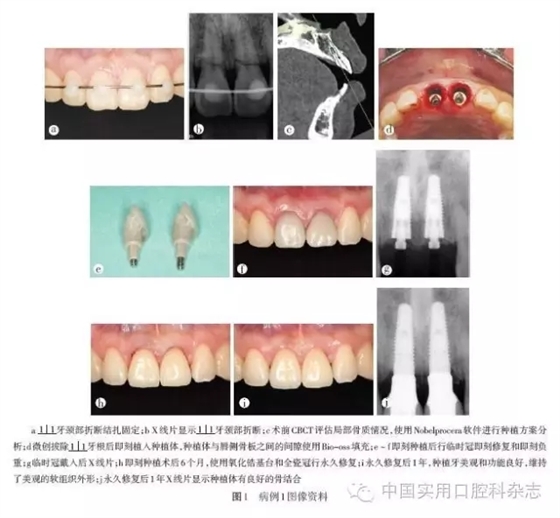 640.webp.jpg 640.webp.jpg