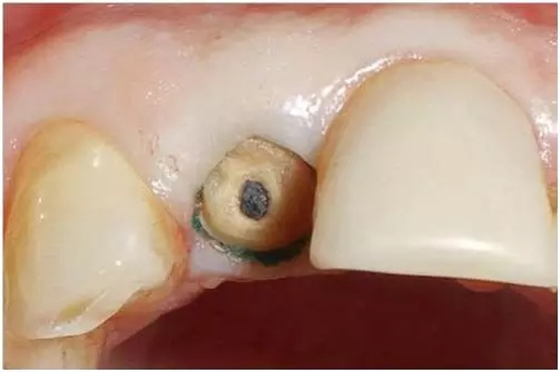 640.webp (3).jpg 640.webp (3).jpg