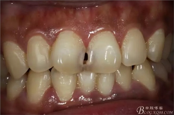 640.webp.jpg 640.webp.jpg