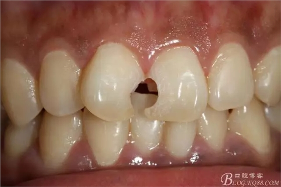 640.webp (1).jpg 640.webp (1).jpg