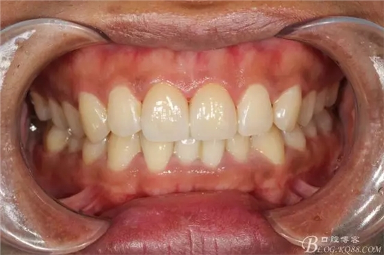 640.webp (9).jpg 640.webp (9).jpg