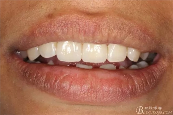 640.webp (16).jpg 640.webp (16).jpg