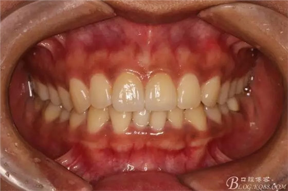 640.webp (17).jpg 640.webp (17).jpg