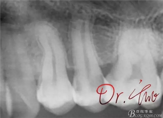 640.webp.jpg 640.webp.jpg