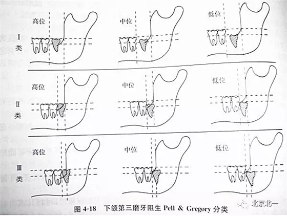 640.webp.jpg 640.webp.jpg