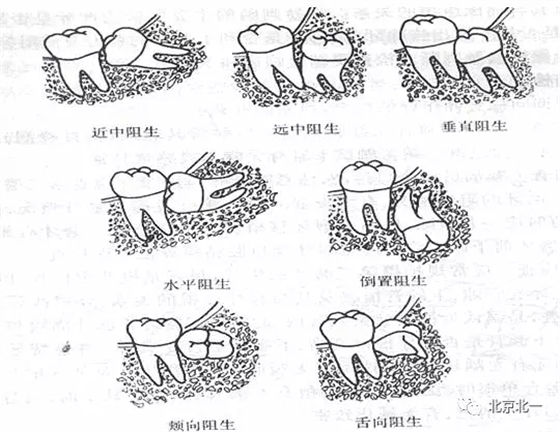 640.webp (1).jpg 640.webp (1).jpg