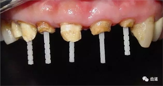 640.webp.jpg 640.webp.jpg