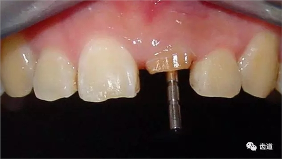 640.webp (6).jpg 640.webp (6).jpg