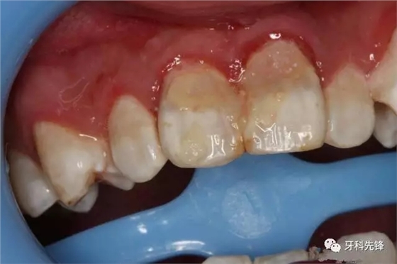 640.webp (2).jpg 640.webp (2).jpg