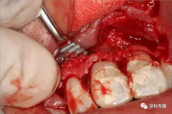 640.webp (8).jpg 640.webp (8).jpg