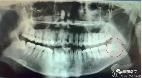 640.webp.jpg 640.webp.jpg