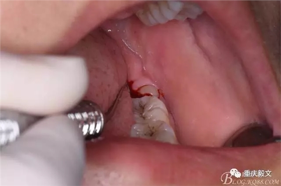 640.webp (4).jpg 640.webp (4).jpg