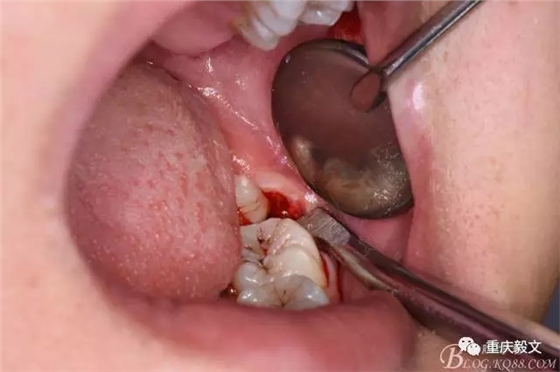 640.webp (11).jpg 640.webp (11).jpg