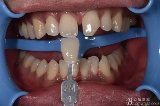 640.webp.jpg 640.webp.jpg