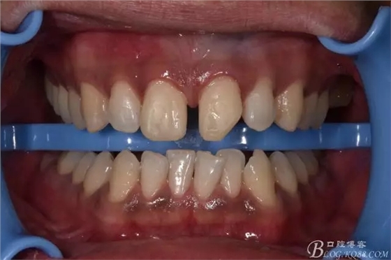 640.webp (5).jpg 640.webp (5).jpg