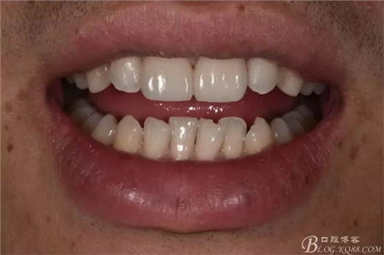 640.webp (9).jpg 640.webp (9).jpg