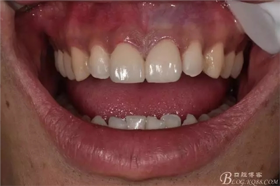 640.webp (10).jpg 640.webp (10).jpg