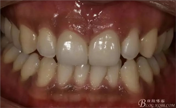 640.webp (11).jpg 640.webp (11).jpg