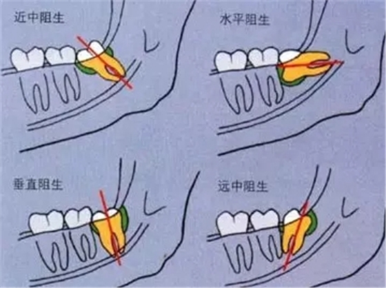 640.webp (3).jpg 640.webp (3).jpg