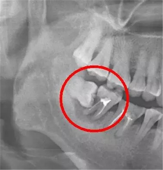 640.webp (4).jpg 640.webp (4).jpg