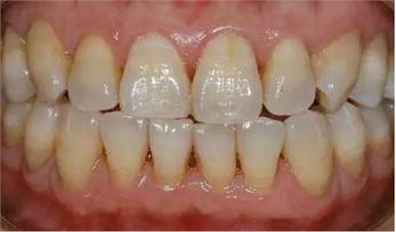 360截圖20170107153740366.jpg 360截圖20170107153740366.jpg