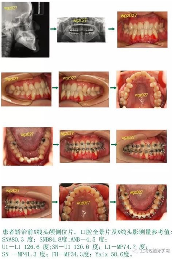 360截圖20170107155935570.jpg 360截圖20170107155935570.jpg