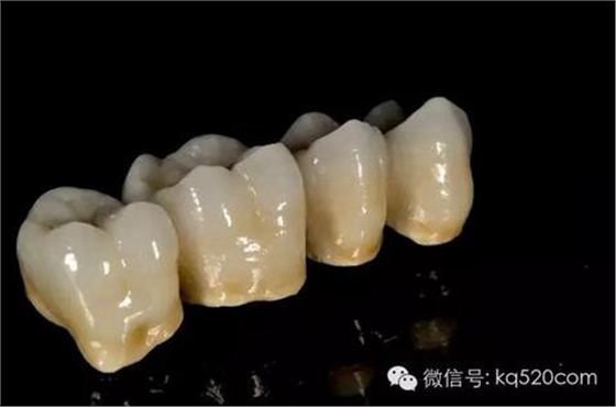 烤瓷牙邊緣變黑，要換新的嗎？