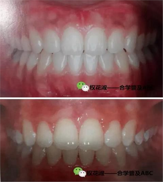 360截圖20170120103007349.jpg 360截圖20170120103007349.jpg