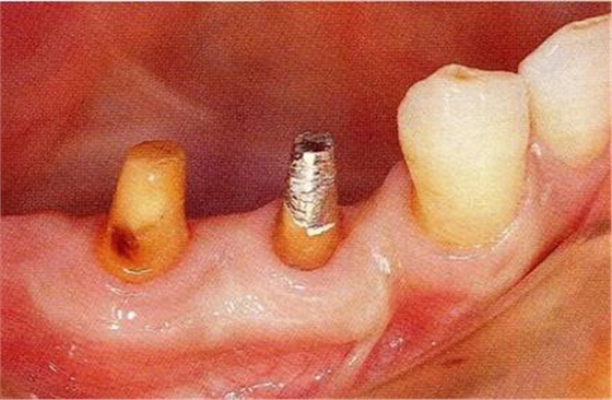 360截圖20170120114040871.jpg 360截圖20170120114040871.jpg