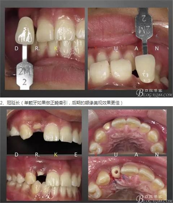 360截圖20170120135159589.jpg 360截圖20170120135159589.jpg