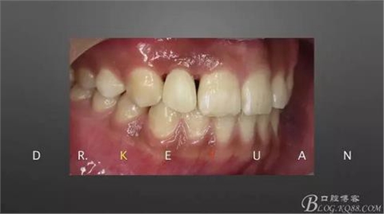 360截圖20170120135227365.jpg 360截圖20170120135227365.jpg