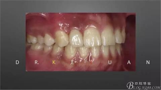 360截圖20170120135310260.jpg 360截圖20170120135310260.jpg